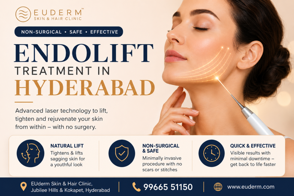 Endolift Hyderabad